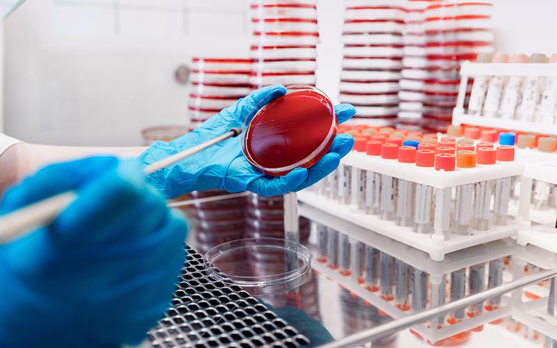 What Does A Blood Culture Test Look For